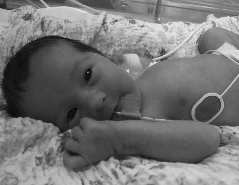 Black and white image of baby with a tube in her mouth