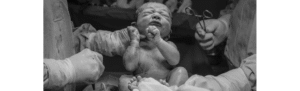 Black and white image of baby being born by gentle caesarean section